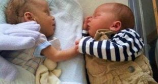 Nurse Puts Dying Baby Next To Her Twin. She Gives Her A ‘Hug’ That Leads To A Miracle