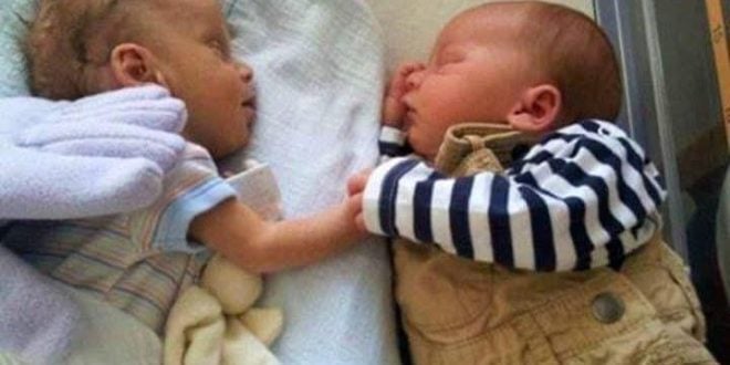 Nurse Puts Dying Baby Next To Her Twin. She Gives Her A ‘Hug’ That Leads To A Miracle