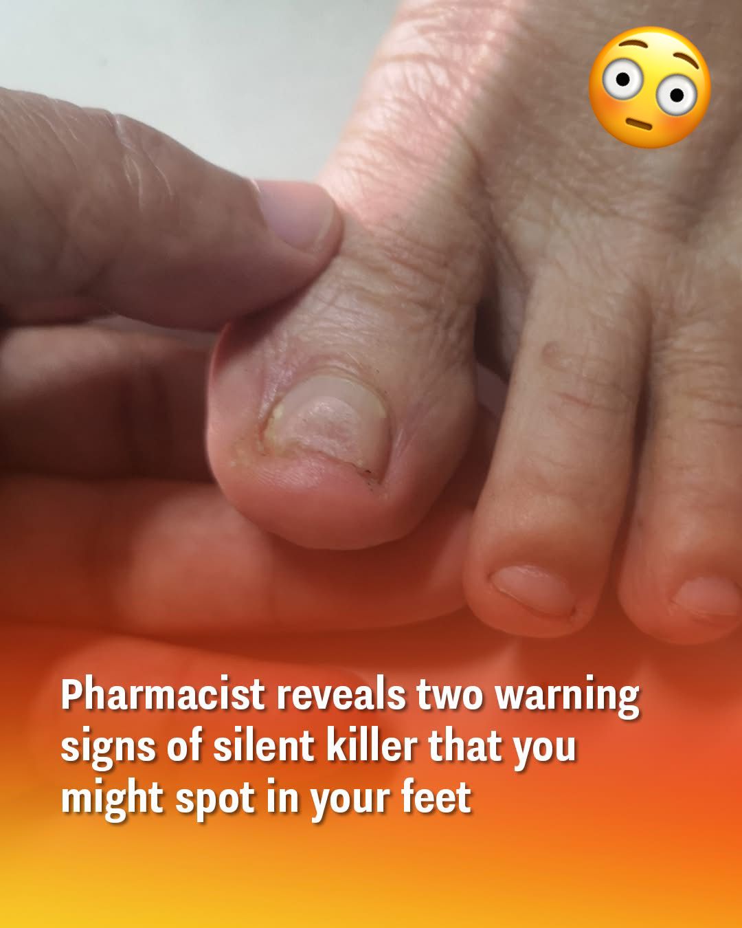 Pharmacist reveals two warning signs of silent killer that you might spot in your feet