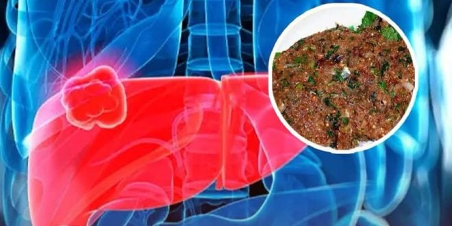 This dish can be the reason why people die of cancer