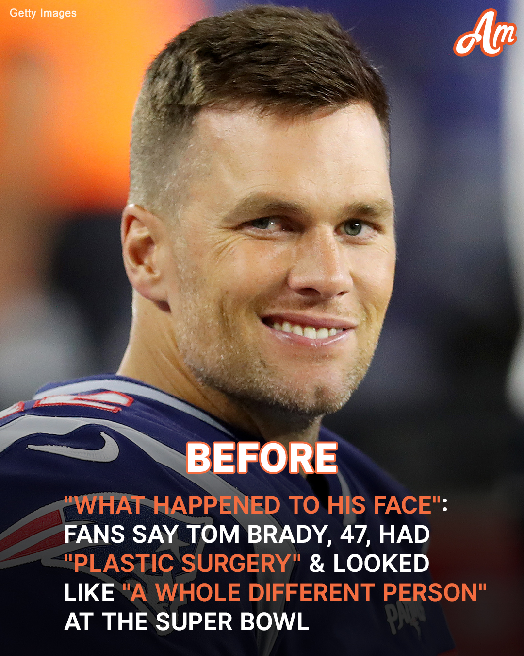 Fans Say Tom Brady, 47, Looks Like a ‘Whole Different Person’ at the 2025 Super Bowl – Photos