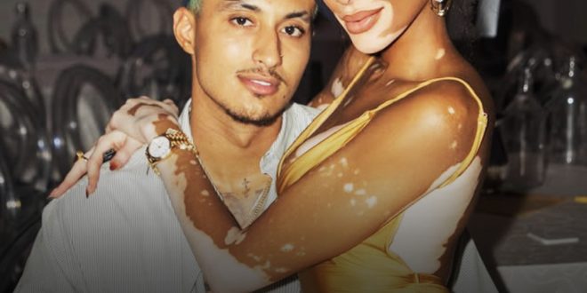 Model Winnie Harlow Gets Engaged to NBA Star Kyle Kuzma – 'Skating Rink' Ring Causes a Stir